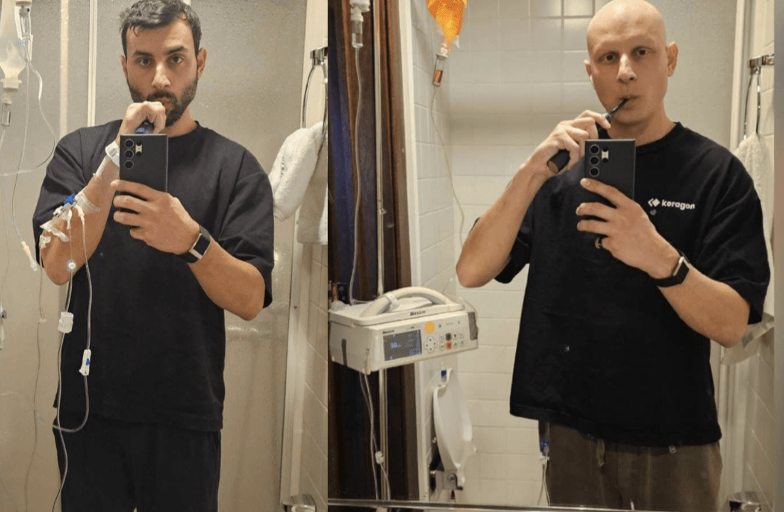 Connor Christou Uses AI to Navigate Lymphoma Diagnosis